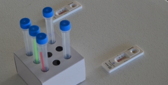 Um mês depois da abertura oficial do Posto Fixo em Lisboa já foram realizados mais de 6 mil testes